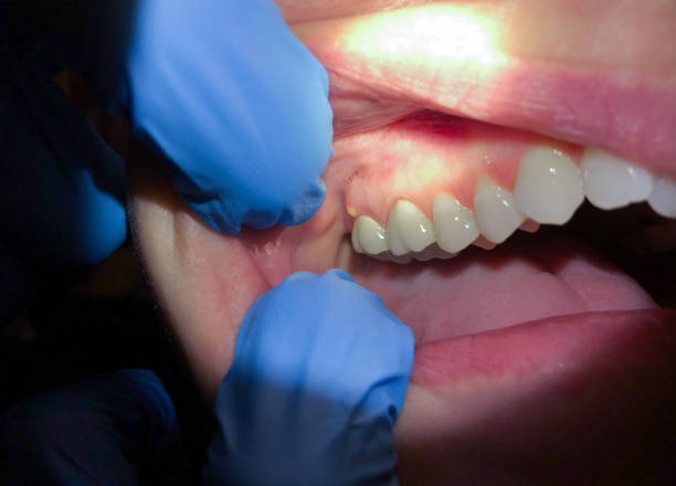 Best Walk-In Emergency Dentist in Brook Highland, AL